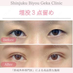 新宿美容外科クリニック 新宿院の症例