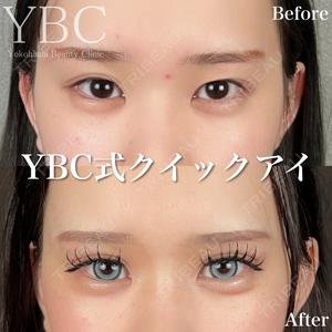 YBC横浜美容外科 池袋院 磯村 亮輔医師の症例