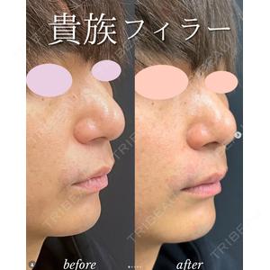 ルラ美容クリニック 札幌大通り院 能登 貴弘医師の症例