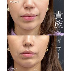 ルラ美容クリニック 札幌大通り院 能登 貴弘医師の症例