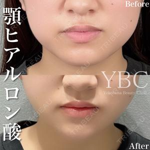 YBC横浜美容外科 池袋院 磯村 亮輔医師の症例
