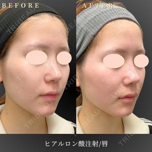 BiBiクリニック 山本 幸一郎医師の症例