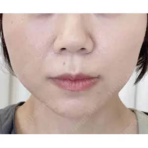 オーキッド美容クリニック東京御徒町 西浦 蘭子医師の症例