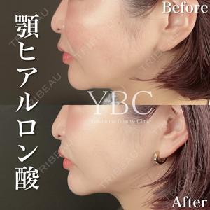 YBC横浜美容外科 立川院 塚原健汰医師の症例