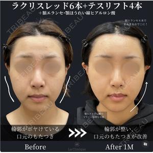 La Clinique Osaka 【ラクリニック大阪】 長瀬 ⼤蔵医師の症例