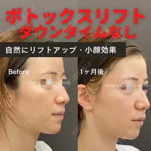 ロレシー美容クリニック 心斎橋駅前院 福留院長医師の症例