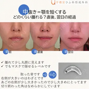 宇都宮ひふ科形成外科 宇都宮 裕己医師の症例