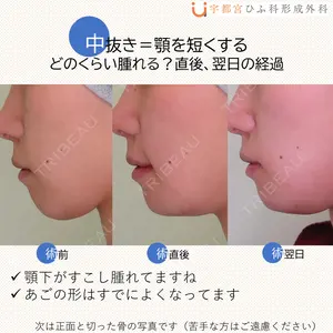 宇都宮ひふ科形成外科 宇都宮 裕己医師の症例