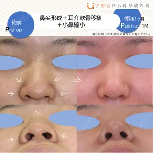 宇都宮ひふ科形成外科 宇都宮 裕己医師の症例