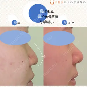 宇都宮ひふ科形成外科 宇都宮 裕己医師の症例