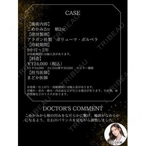 上野注入クリニックの症例