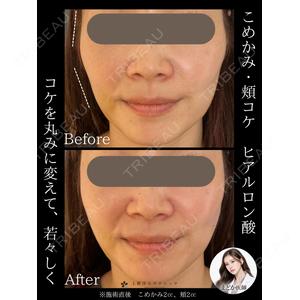 上野注入クリニックの症例