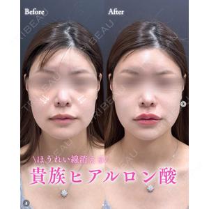 ルラ美容クリニック 札幌大通り院 能登 貴弘医師の症例