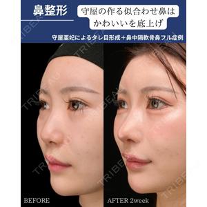 Zetith Beauty Clinic 銀座院 守屋 亜妃医師の症例