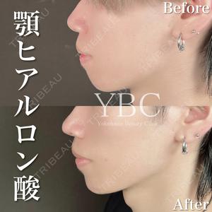 YBC横浜美容外科 池袋院 磯村 亮輔医師の症例