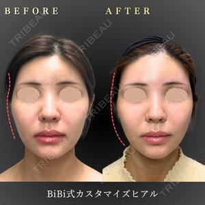 BiBiクリニック 山本 幸一郎医師の症例