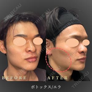 BiBiクリニック 山本 幸一郎医師の症例