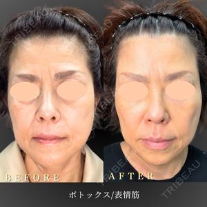 BiBiクリニック 山本 幸一郎医師の症例