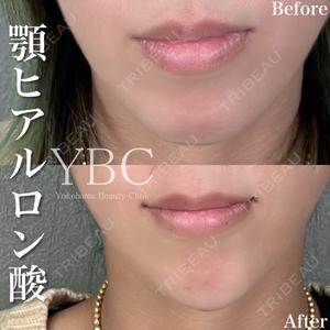 YBC横浜美容外科 池袋院 磯村 亮輔医師の症例