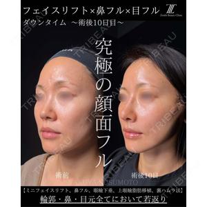 Zetith Beauty Clinic 大阪心斎橋院 楠本 拓哉医師の症例