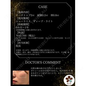 上野注入クリニック 針生　昂人医師の症例