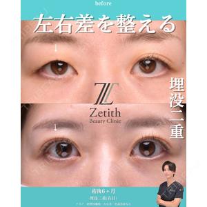 Zetith Beauty Clinic 銀座院の症例