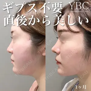 YBC横浜美容外科 池袋院 磯村 亮輔医師の症例