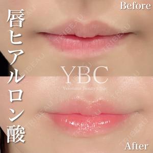 YBC横浜美容外科 池袋院 磯村 亮輔医師の症例