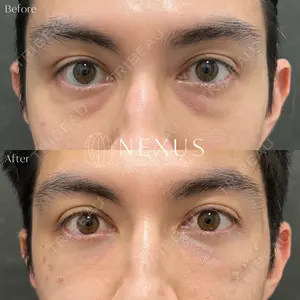 NEXUS CLINICの症例