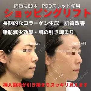 ロレシー美容クリニック 心斎橋駅前院 福留院長医師の症例