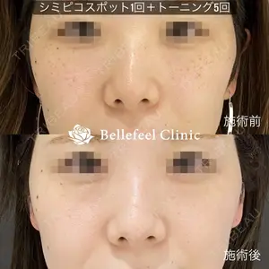 Bellefeel Clinic 代官山 兵藤 秀忠 医師の症例