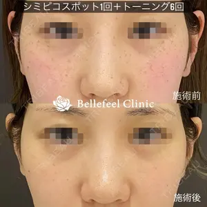 Bellefeel Clinic 代官山 兵藤 秀忠 医師の症例