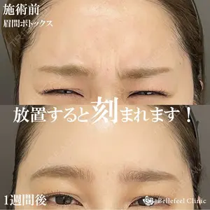 Bellefeel Clinic 代官山 兵藤 秀忠 医師の症例