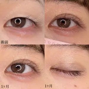 東京シンデレラ美容外科 池袋院の症例