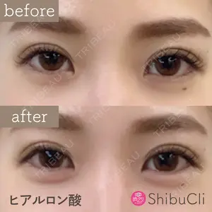 渋谷美容外科クリニック 新宿院 野口 なつ美医師の症例