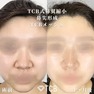 TCB東京中央美容外科 広島院 山内 崇史医師の症例
