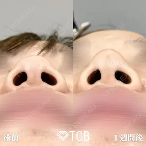 TCB東京中央美容外科 広島院 山内 崇史医師の症例