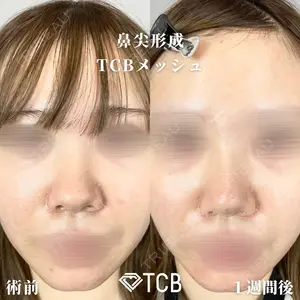 TCB東京中央美容外科 広島院 山内 崇史医師の症例