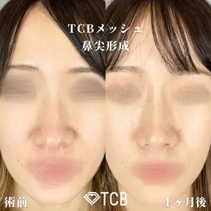 TCB東京中央美容外科 広島院 山内 崇史医師の症例