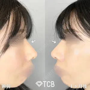 TCB東京中央美容外科 広島院 山内 崇史医師の症例