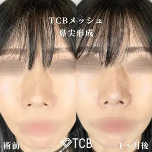 TCB東京中央美容外科 広島院 山内 崇史医師の症例