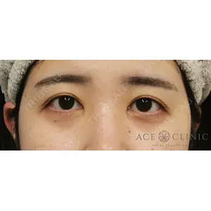 エースクリニック 大阪梅田HEPナビオ院 谷　聡柄医師の症例