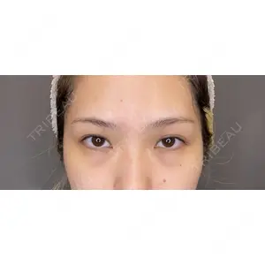 東京美容医療クリニック 池袋院 早坂　李枝医師の症例