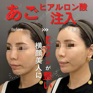 ロレシー美容クリニック 心斎橋駅前院 福留院長医師の症例