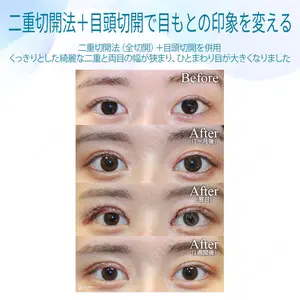聖心美容クリニック 六本木院 伊藤 康平医師の症例
