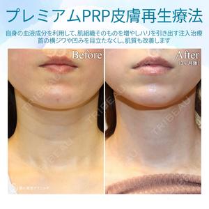 聖心美容クリニック 六本木院の症例