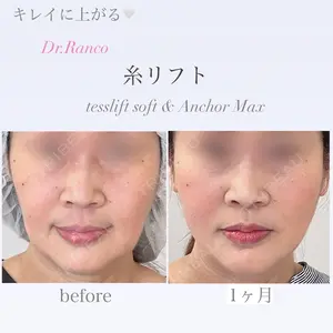 オーキッド美容クリニック東京御徒町 西浦 蘭子医師の症例