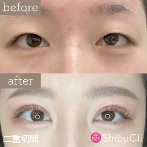 渋谷美容外科クリニック 新橋院 藏薗 侑人医師の症例