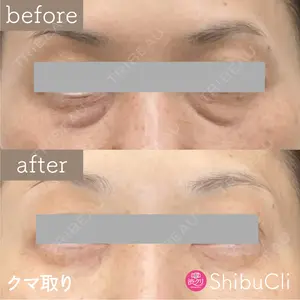 渋谷美容外科クリニック 新橋院 藏薗 侑人医師の症例