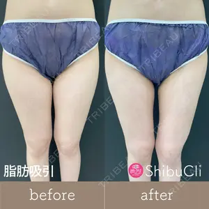 渋谷美容外科クリニック 新橋院 藏薗 侑人医師の症例